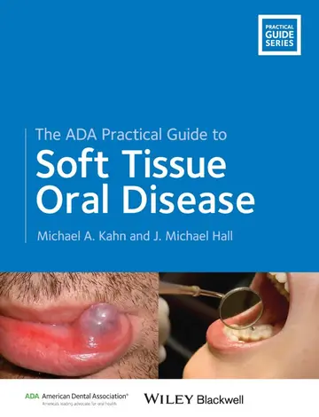 Cover of The ADA Practical Guide to Soft Tissue Oral Disease