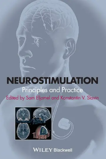 Cover of Neurostimulation