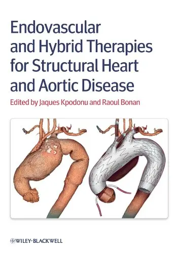 Cover of Endovascular and Hybrid Therapies for Structural Heart and Aortic Disease