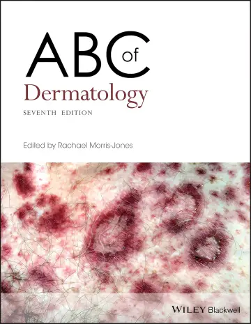 Cover of ABC of Dermatology