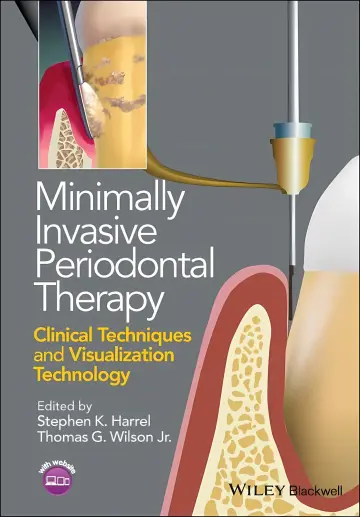 Cover of Minimally Invasive Periodontal Therapy