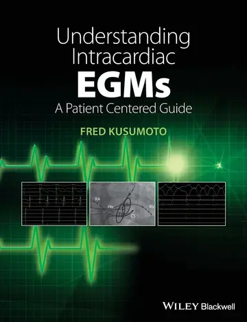 Cover of Understanding Intracardiac EGMs