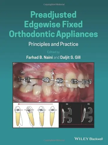 Cover of Preadjusted Edgewise Fixed Orthodontic Appliances