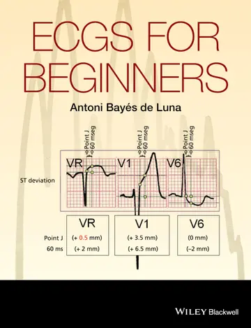 Cover of ECGs for Beginners