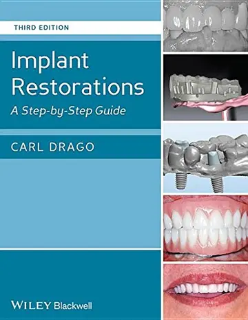 Cover of Implant Restorations