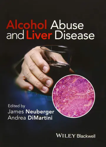 Cover of Alcohol Abuse and Liver Diseasen