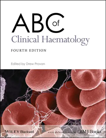 Cover of ABC of Clinical Haematology 4e