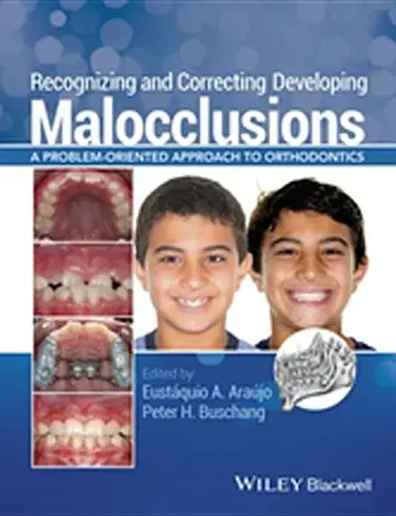 Cover of Recognizing and Correcting Developing Malocclusions