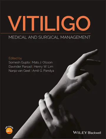 Cover of Vitiligo