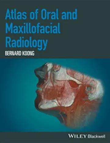 Cover of Atlas of Oral and Maxillofacial Radiology