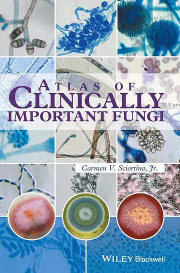 Cover of Atlas of Clinically Important Fungi