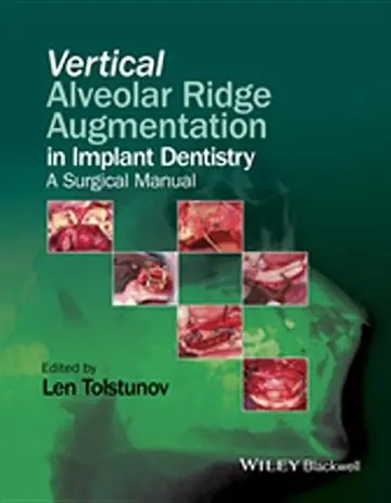 Cover of Vertical Augmentation of the Alveolar Ridge in Implant Dentistry