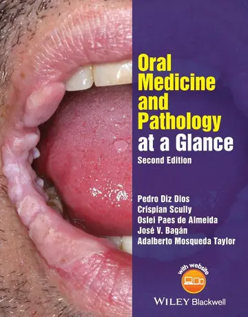 Cover of Oral Medicine and Pathology at A Glance 2Ed (Pb 2016) (At a Glance (Dentistry))