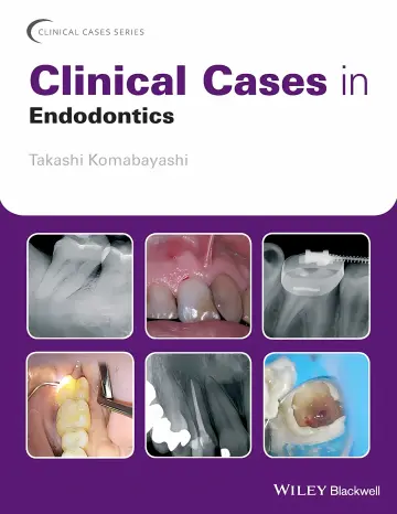 Cover of Clinical cases in endodontics