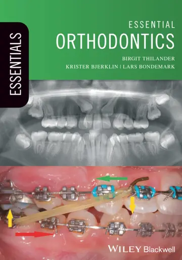 Cover of Essential Orthodontics (Pb 2018) (Essentials (Dentistry))