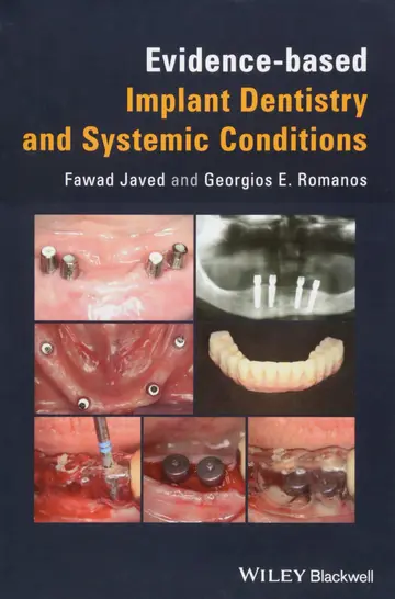 Cover of Evidence-based Implant Dentistry and Systemic Conditions