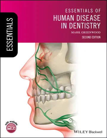 Cover of Essentials of Human Disease in Dentistry 2Ed (Pb 2018) (Essentials (Dentistry))