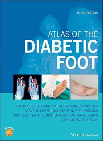 Cover of Atlas of the Diabetic Foot 3Ed