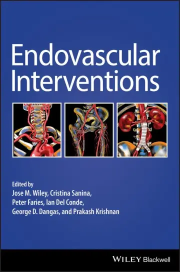 Cover of Endovascular Interventions