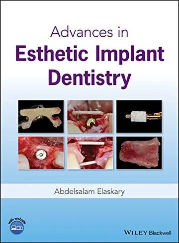 Cover of Advances in Esthetic Implant Dentistry