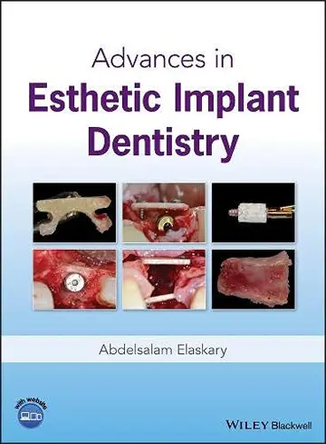 Cover of Advances in Esthetic Implant Dentistry