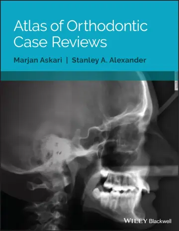 Cover of Atlas of Orthodontic Case Reviews