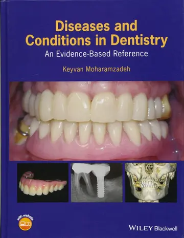 Cover of Diseases and Conditions in Dentistry