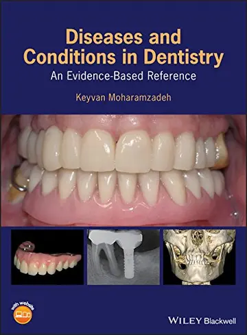Cover of Diseases and Conditions in Dentistry