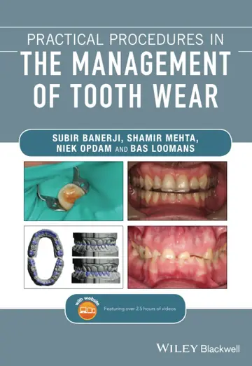 Cover of Practical Procedures in the Management of Tooth Wear