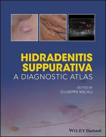 Cover of Hidradenitis Suppurativa