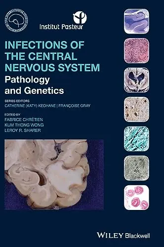 Cover of Infections of the Central Nervous System
