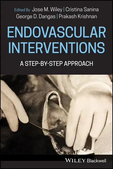Cover of Endovascular Interventions