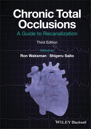 Cover of Chronic Total Occlusions