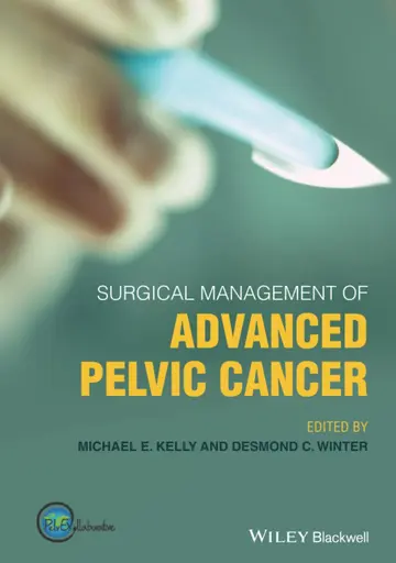 Cover of Surgical Management of Advanced Pelvic Cancer