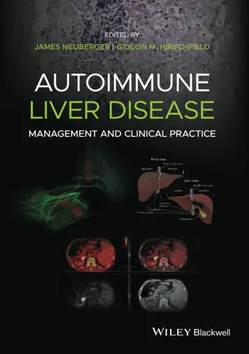 Cover of Autoimmune Liver Disease