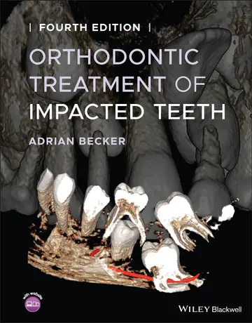 Cover of Orthodontic Treatment of Impacted Teeth