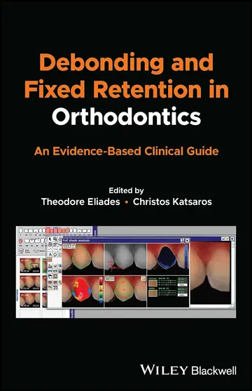 Cover of Debonding and Fixed Retention in Orthodontics