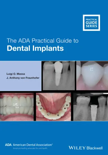 Cover of The ADA Practical Guide to Dental Implants