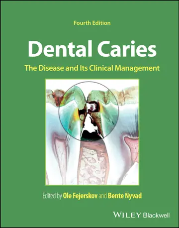 Cover of Dental Caries