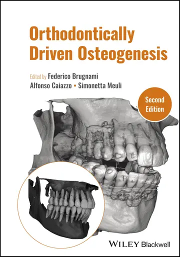 Cover of Orthodontically Driven Osteogenesis