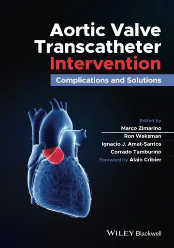 Cover of Aortic Valve Transcatheter Intervention