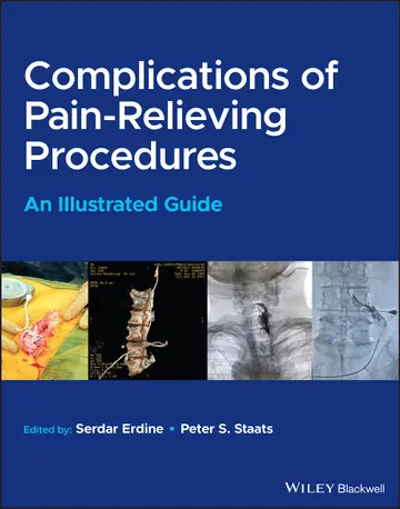 Cover of Complications of Pain-Relieving Procedures