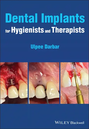 Cover of Dental Implants for Hygienists and Therapists