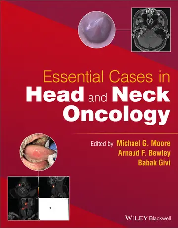 Cover of Essential Cases in Head and Neck Oncology