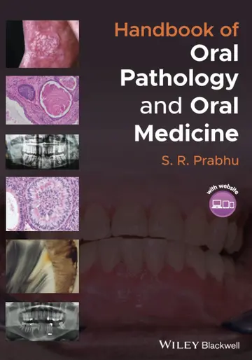 Cover of Handbook of Oral Pathology and Oral Medicine