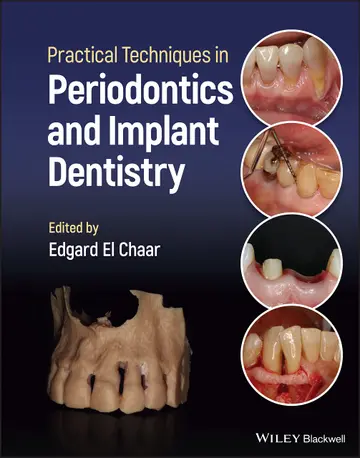 Cover of Practical Techniques in Periodontics and Implant Dentistry
