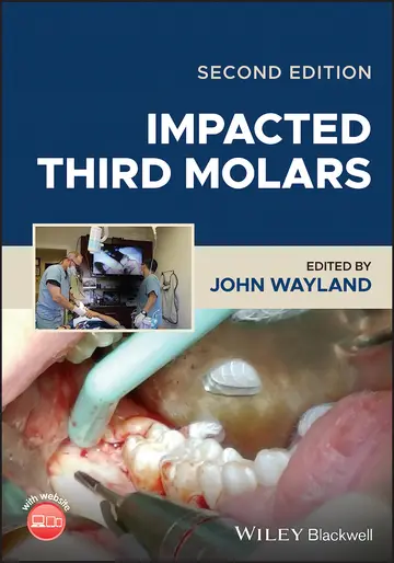 Cover of Impacted Third Molars 2Ed