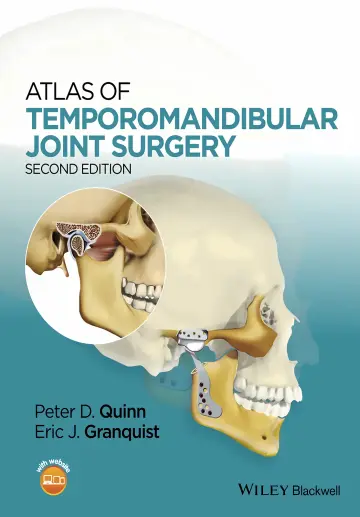 Cover of Atlas of Temporomandibular Joint Surgery 2Ed
