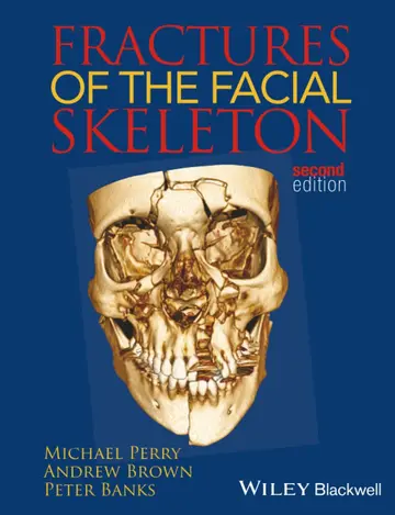 Cover of Fractures of the Facial Skeleton