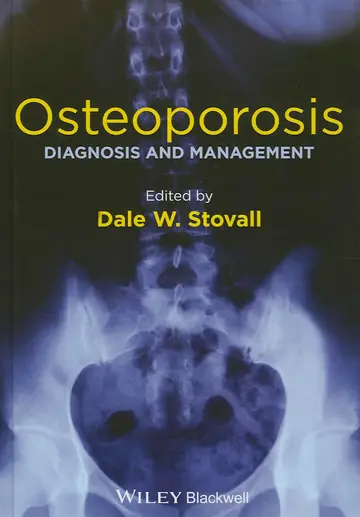Cover of Osteoporosis Diagnosis and Management